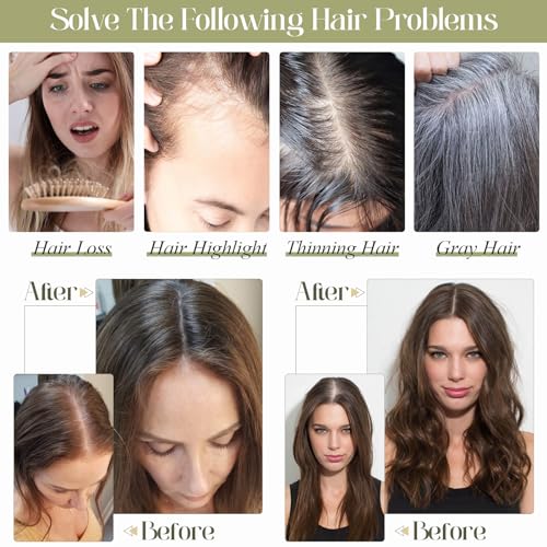 Medium Brown 10 Inch 100% Remy Human Hair Topper N3711